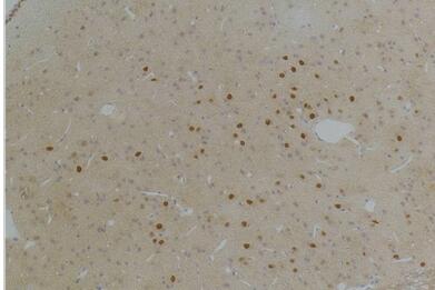 Kv1.1 potassium channel Polyclonal Antibody