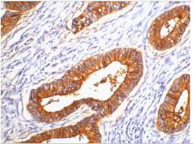 Carcinoembryonic Antigen Monoclonal Antibody