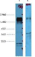 HER2 Monoclonal Antibody