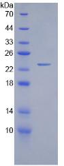 Recombinant Lipolysis Stimulated Lipoprotein Receptor (LSR)