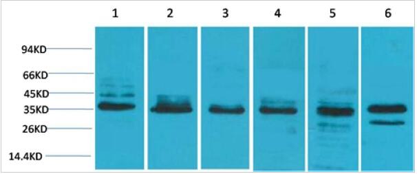 TBP Polyclonal Antibody