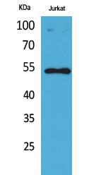 p53 (Acetyl Lys372) Polyclonal Antibody