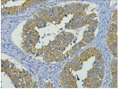 CK19 Monoclonal Antibody