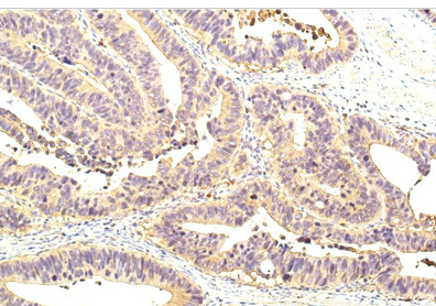 STAT1 Mouse Monoclonal Antibody(8H11)