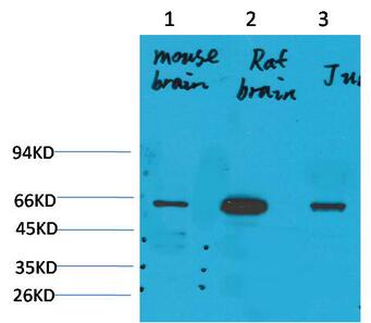 KCNK10 (TREK-2) Polyclonal Antibody