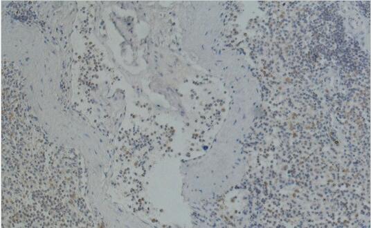 CD41 Monoclonal Antibody
