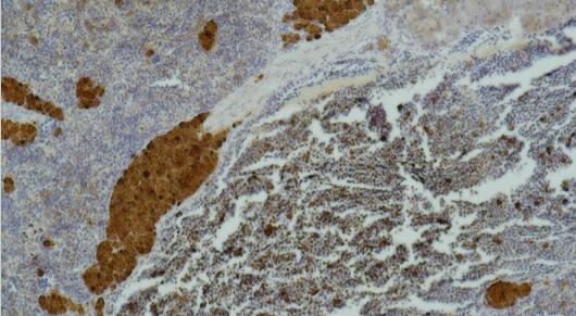CD25 Monoclonal Antibody