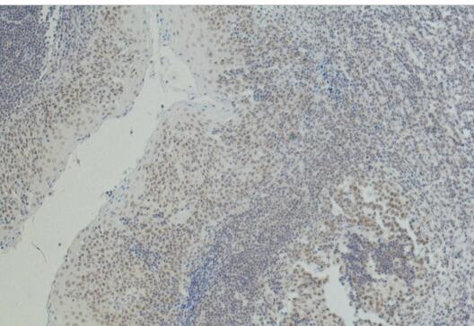 CD2 Monoclonal Antibody