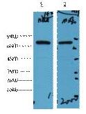 HSP70 Monoclonal Antibody