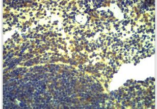 TLR2 Polyclonal Antibody