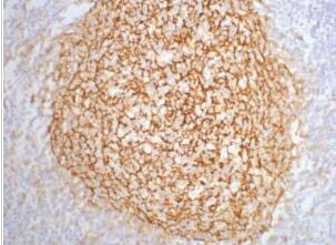 CD21 Monoclonal Antibody