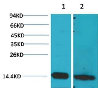 S100 β Polyclonal Antibody