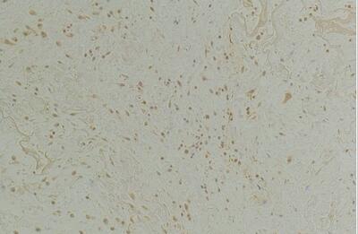 CLIC1 Polyclonal Antibody