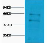 c-Myc Polyclonal Antibody