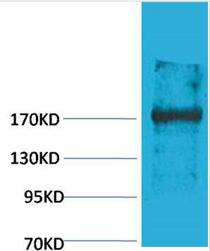 EPG5 Polyclonal Antibody