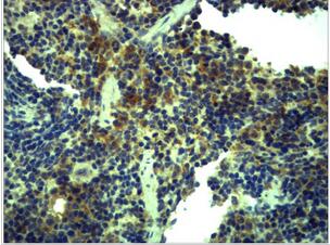 TLR1 Polyclonal Antibody
