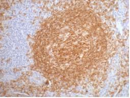 CD20 Monoclonal Antibody