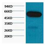 β I tubulin Monoclonal Antibody