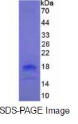 Eukaryotic Tumor Necrosis Factor Ligand Superfamily, Member 18 (TNFSF18)
