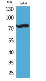 p73 (Acetyl Lys327) Polyclonal Antibody