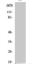 Cleaved-Integrin α5 LC (E895) Polyclonal Antibody