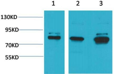 ASIC1 Polyclonal Antibody