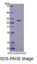 Recombinant Phosphoglucomutase 2 (PGM2)
