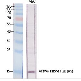 Histone H2B (Acetyl Lys5) Polyclonal Antibody