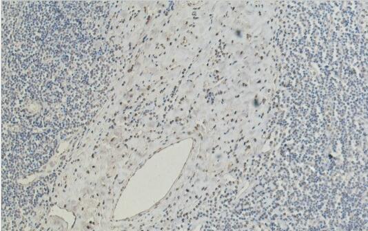 CD5 Monoclonal Antibody