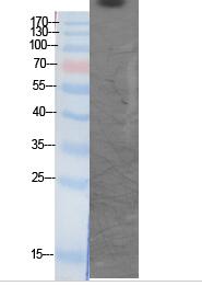 CBP (Acetyl Lys1535) Polyclonal Antibody