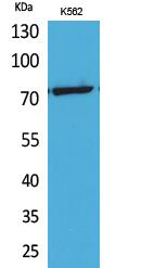 p73 (Acetyl Lys321) Polyclonal Antibody