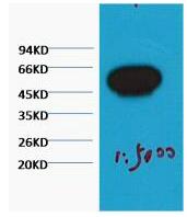 β-Tubulin Monoclonal Antibody