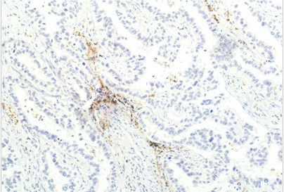 JAK1 Mouse Monoclonal Antibody(7G6)