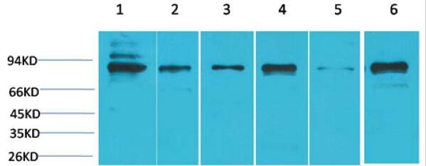 STAT5b Polyclonal Antibody