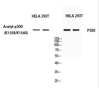 p300 (Acetyl Lys1558/Acetyl Lys1560) Polyclonal Antibody