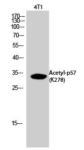 p57 (Acetyl Lys278) Polyclonal Antibody