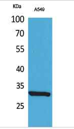 ATF-5 (Acetyl Lys29) Polyclonal Antibody