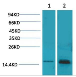 S100 Polyclonal Antibody