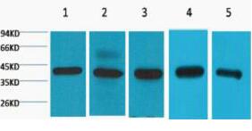 eIF4A1 Monoclonal Antibody