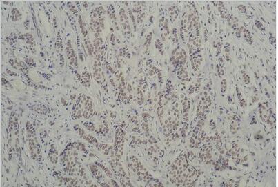 TBP/TATA Binding Protein Monoclonal Antibody