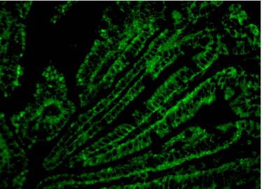 CD4 Monoclonal Antibody
