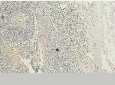 CD1 Monoclonal Antibody