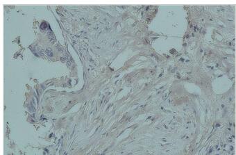 PR Monoclonal Antibody