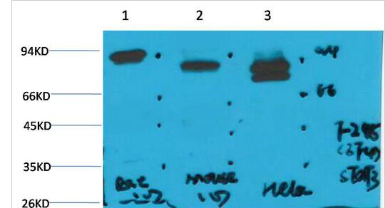 STAT3 Monoclonal Antibody