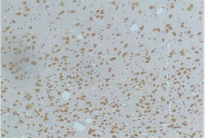 CaMKIIβ/γ/δ (Phospho Thr287) Monoclonal Antibody