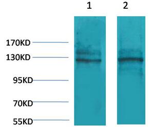 CASR Polyclonal Antibody