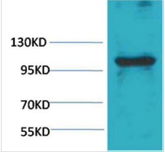 eEF1A2 binding protein Polyclonal Antibody
