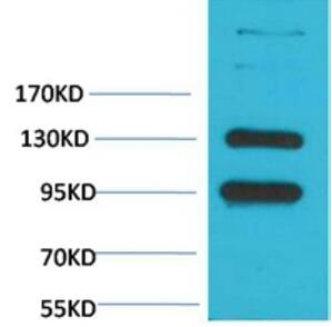 CaVα2δ1 Polyclonal Antibody