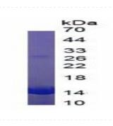 Native Hemoglobin (HB)