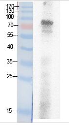 Ub (Acetyl Lys29) Polyclonal Antibody